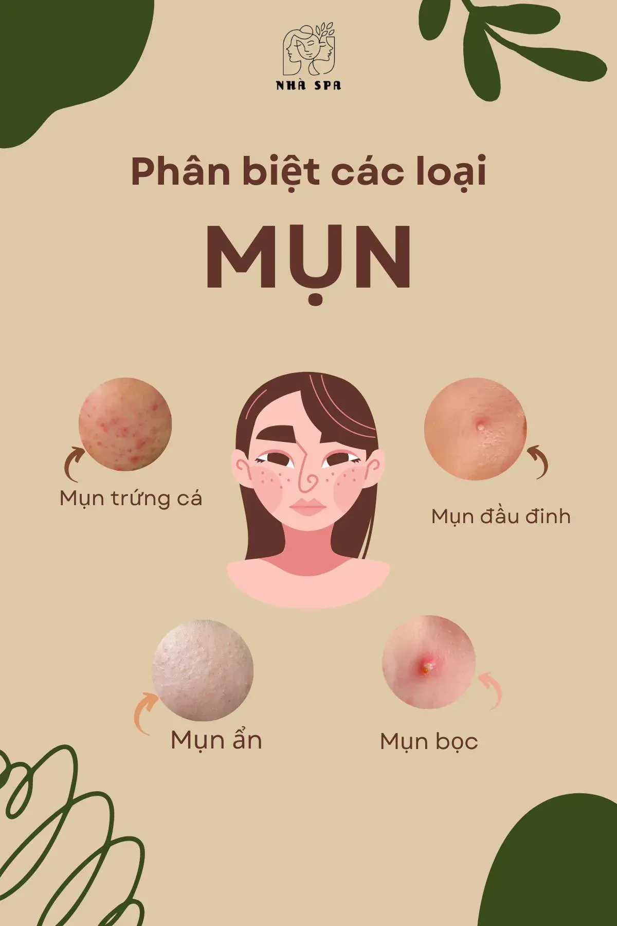 phan biet cac loai mun 1