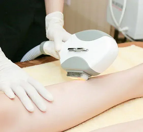 Triệt lông vĩnh viễn